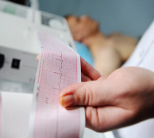 ELECTROCARDIÓGRAFOS