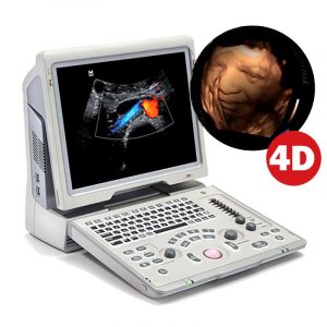 Ultrasonido Z6 4D, sistema portátil de ecografía Mindray para uso humano (SIN TRANSDUCTORES